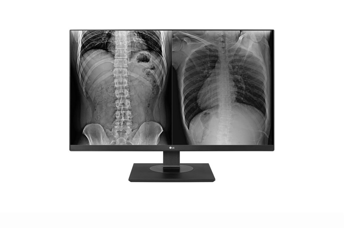 Monitor 27 inch LG 27HJ713C-B.AEE 3840 x 2160, 60 Hz